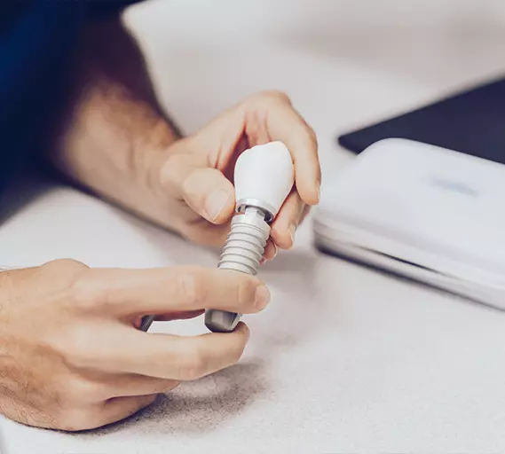 Endo-Estetica. OFERTA IMPLANTY.